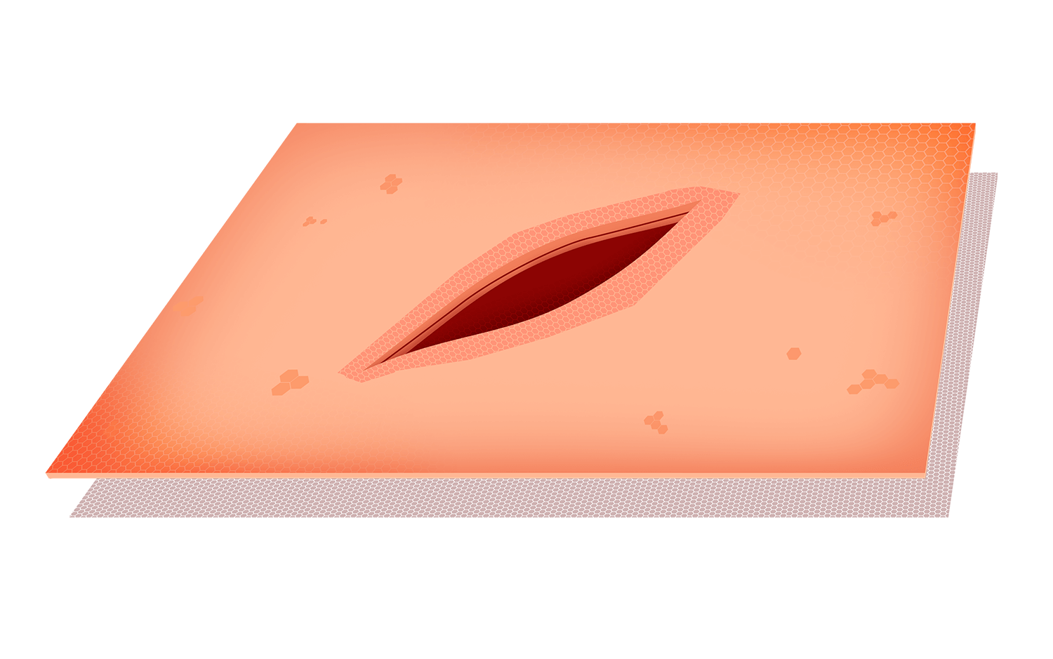 Schnittwunden