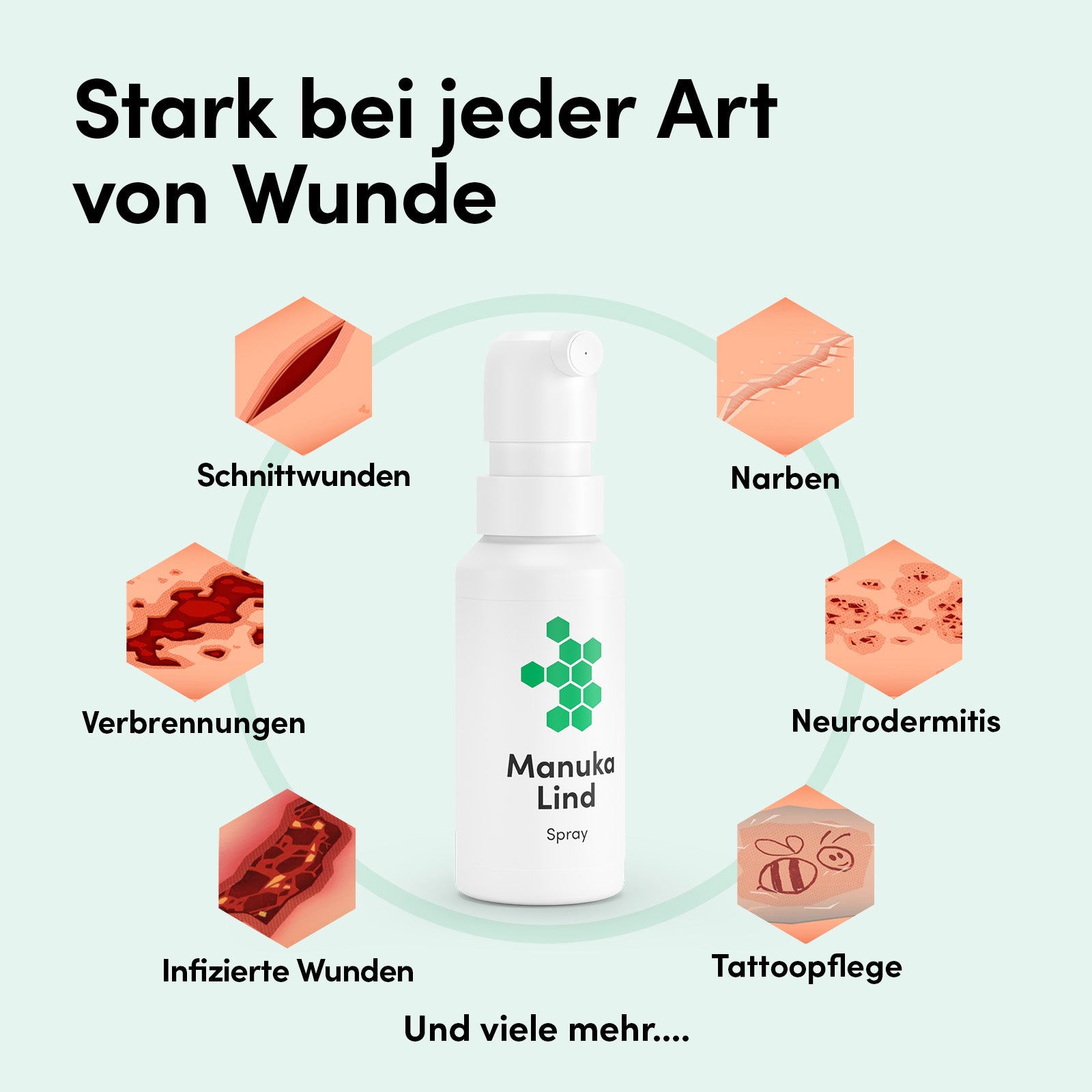 ManukaLind Wundheilspray
