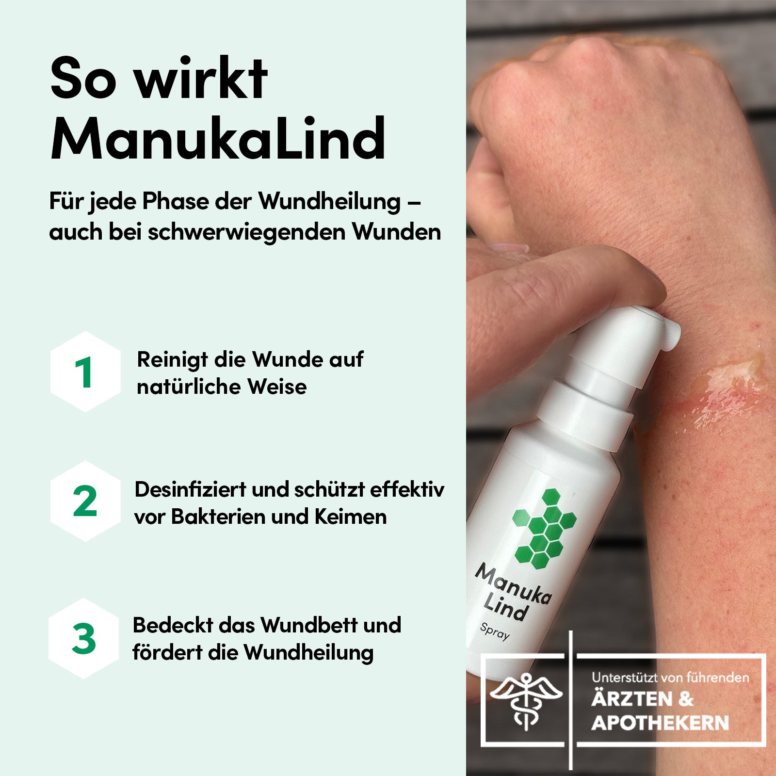 ManukaLind Wundheilspray