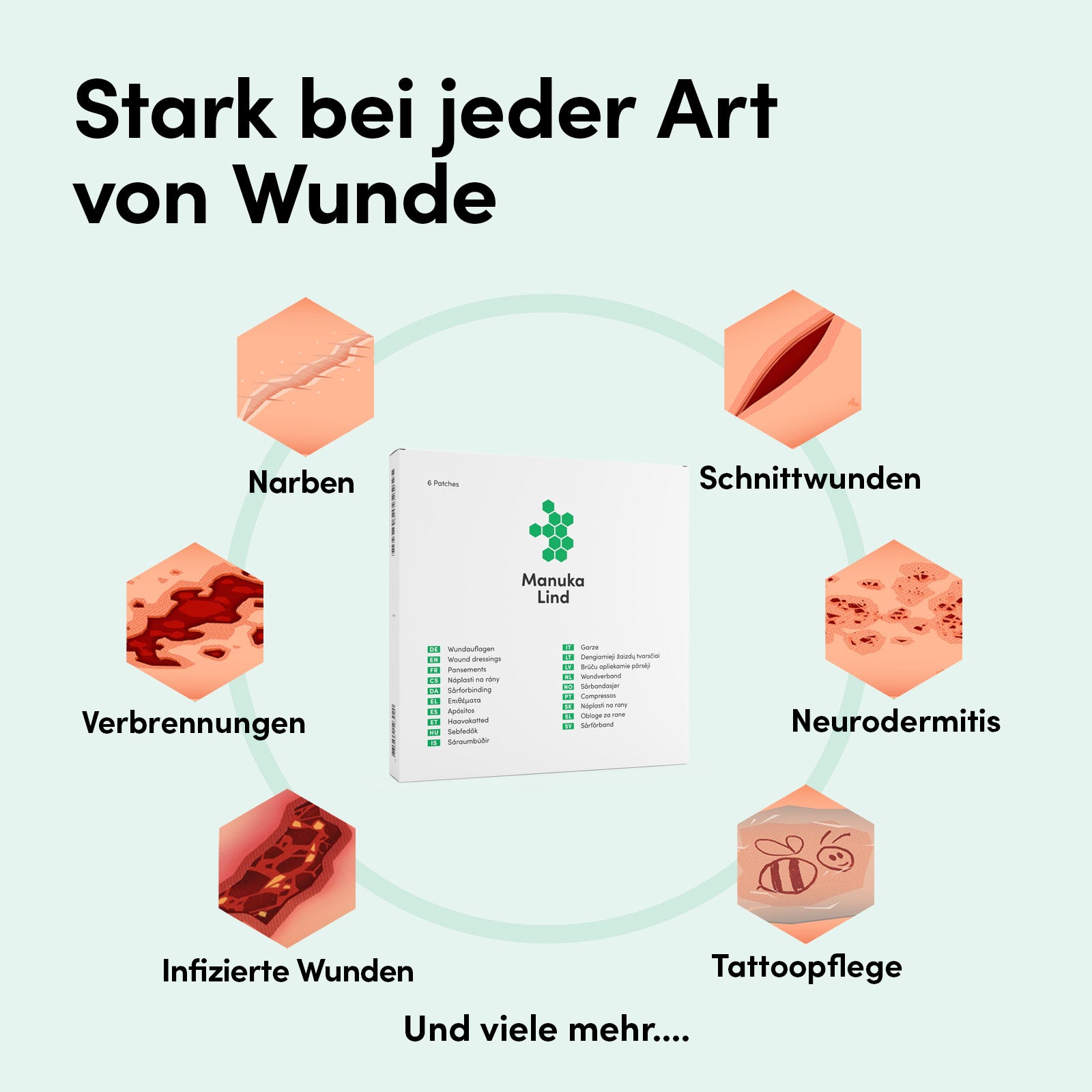 ManukaLind Wundauflagen