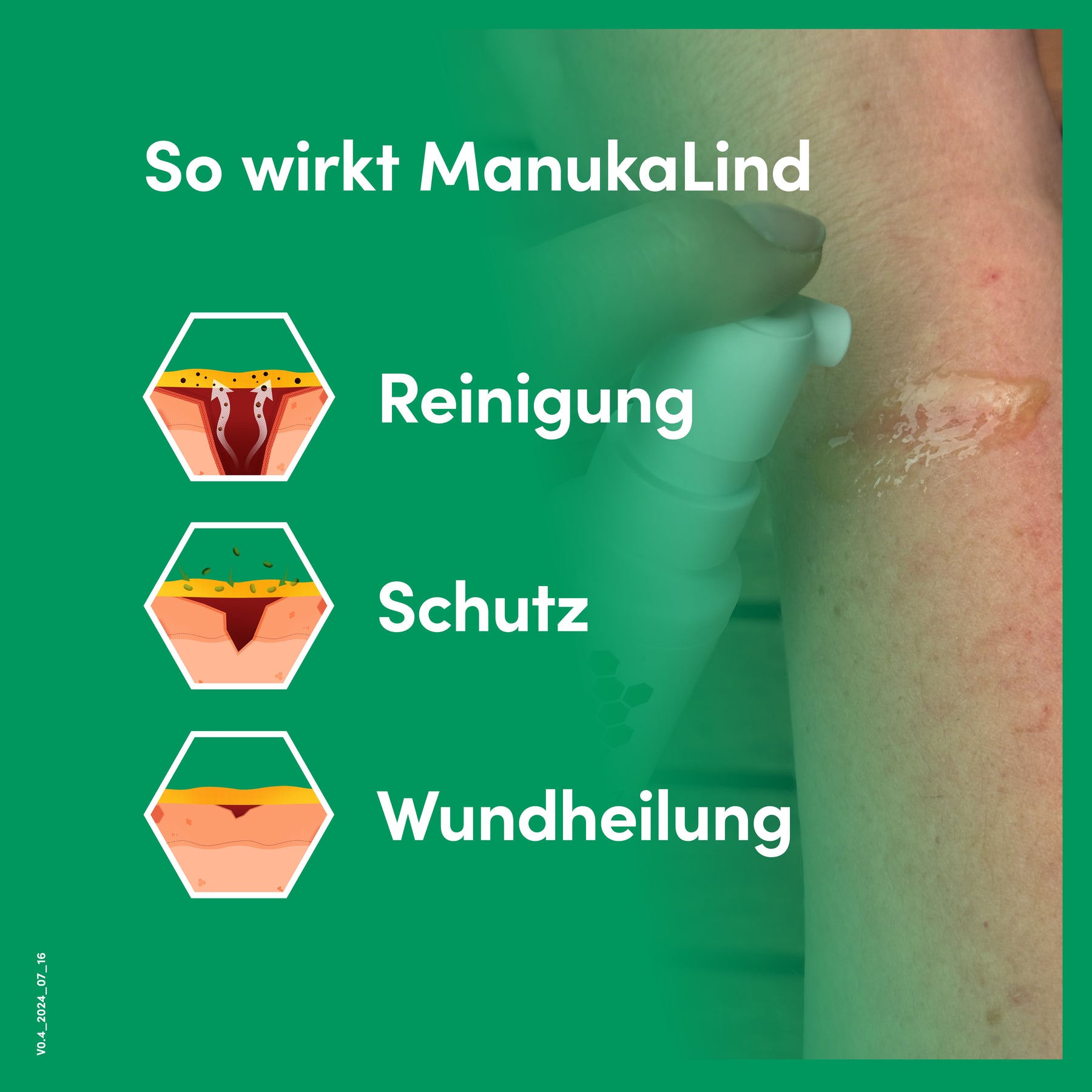 Duo ManukaLind Wundheilung